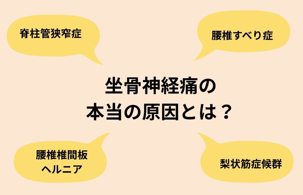 坐骨神経痛の原因